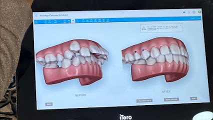 Krushna Orthodontic and Dental Clinic Sinhagad Road
